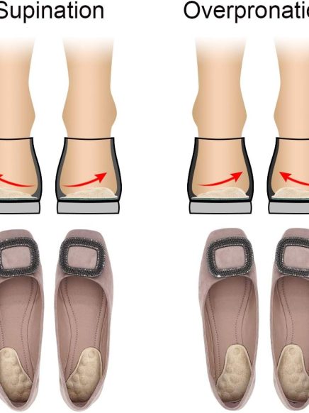 Supination & Over-Pronation Corrective Shoe Inserts, Medial & Lateral Heel Wedge Insoles for Foot Alignment, Knee Pain, Bow Legs, Osteoarthritis - 3 Pairs (Beige)